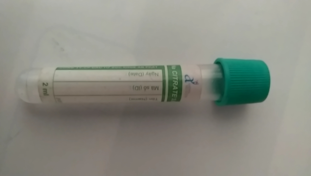Ống nghiệm citrate 2.0ml