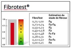 FIBROTEST